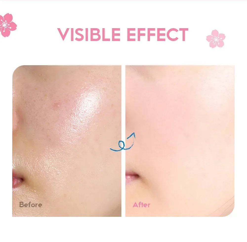Crema Facial LAIKOU Sakura - Hidratante Profunda, Blanqueadora y Reparadora. Sella la Humedad y Controla la Grasa. Fórmula Suave.