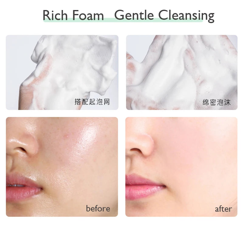 Limpiador Facial Blanqueador PTWOP (Espuma) - Limpieza Profunda, Control Grasa, Acné y Minimiza Poros. Hidratante y Exfoliante.